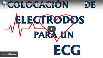 Vdeo Colocacin de Electrodos en la realizacin de un ECG