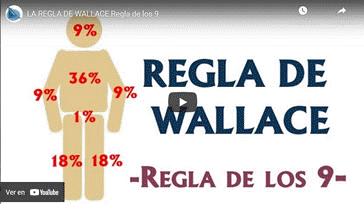 Vdeo Regla de Wallace - Regla de los 9