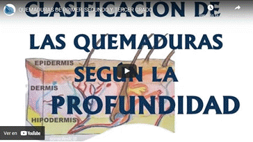 Vdeo Clasificacin de las Quemaduras segn la Profundidad