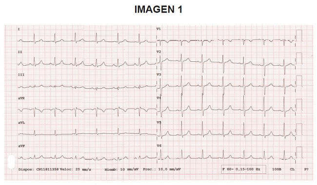 Examen EIR 2019/20 - Imagen nº 1